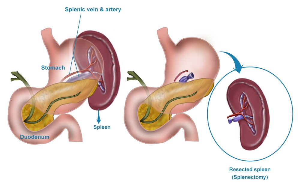 Robotic Surgery in Electronic City